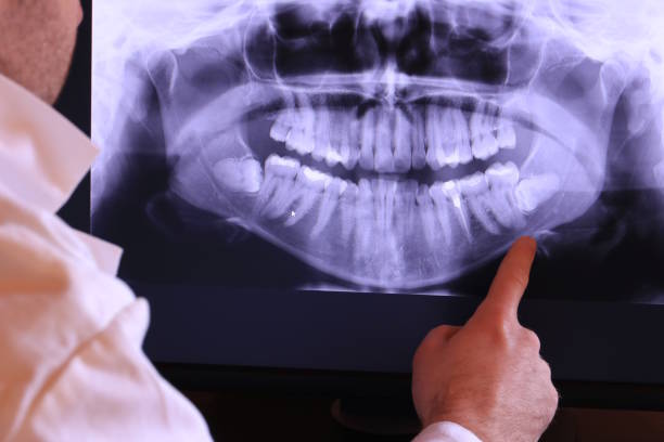 Best Broken Tooth Emergency  in Lafayette, IN